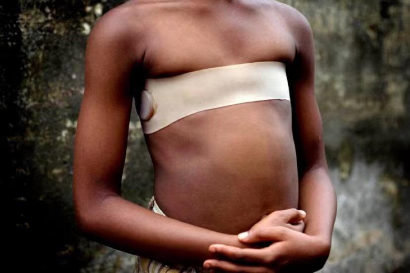 A young  African girl wearing a band to flatten her breasts.