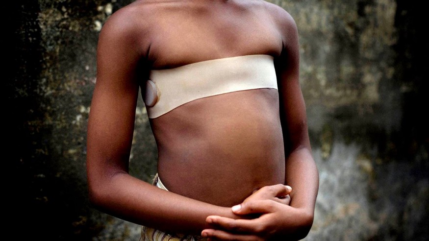 African young girl wearing a band to flatten her breasts; Source: Mirror